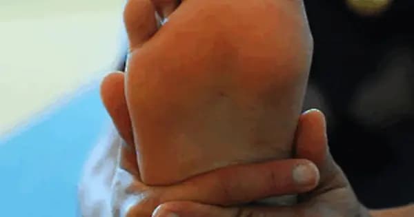 Osteoporose - Træning med knogleskørhed med Idun